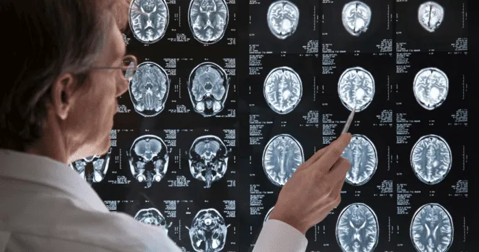 SI-BrAInomiX project starts